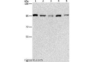 Western blot analysis of HepG2, K562, Jurkat, 231 and hela cell, using MCM5 Polyclonal Antibody at dilution of 1:475 (MCM5 anticorps)