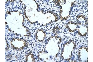 Rabbit Anti-GNAS Antibody       Paraffin Embedded Tissue:  Human alveolar cell   Cellular Data:  Epithelial cells of renal tubule  Antibody Concentration:   4. (GNAS anticorps  (N-Term))