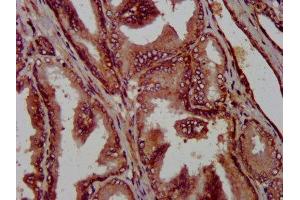 IHC image of ABIN7169262 diluted at 1:1000 and staining in paraffin-embedded human prostate tissue performed on a Leica BondTM system.