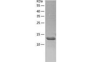 Western Blotting (WB) image for NudC Domain Containing 2 (NUDCD2) (AA 1-157) protein (His-IF2DI Tag) (ABIN7124235)