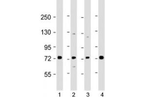 Western blot testing of human 1) Raji, 2) A549, 3) HL-60 and 4) K562 cell lysate with SKI antibody at 1:2000. (SKI anticorps  (AA 21-54))