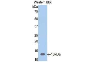 Western blot analysis of the recombinant protein. (Vitamin D-Binding Protein anticorps  (AA 395-475))