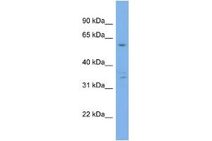 WB Suggested Anti-UBQLN4  Antibody Titration: 0. (UBQLN4 anticorps  (Middle Region))