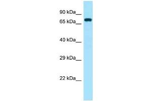 Western Blotting (WB) image for anti-zeta-Chain (TCR) Associated Protein Kinase 70kDa (ZAP70) (Middle Region) antibody (ABIN2788711) (ZAP70 anticorps  (Middle Region))