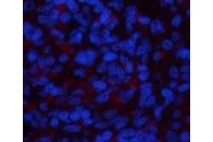 Immunofluorescence analysis of Rat spleen tissue using NBR1 Monoclonal Antibody at dilution of 1:200. (NBR1 anticorps)