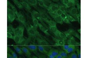 Immunofluorescence analysis of C6 cells using HAL Polyclonal Antibody at dilution of 1:100 (40x lens).