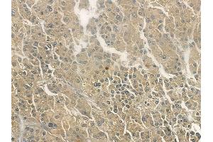 ABIN6255412 and ABIN6267113 at 1/100 staining human normal lung tissue by IHC-P.