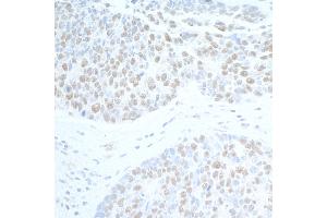 Immunohistochemistry (IHC) image for anti-Suppressor of Ty 6 Homolog (SUPT6H) (AA 425-475) antibody (ABIN7453850) (Spt6 anticorps  (AA 425-475))