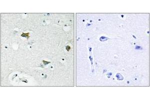 Immunohistochemistry analysis of paraffin-embedded human brain tissue, using BAD (Ab-91/128) Antibody. (BAD anticorps  (AA 61-110))
