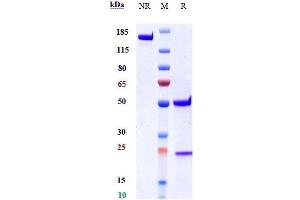 Anti-IL-1RL1 / ST2 / IL-33R Reference Antibody (astegolimab) on SDS-PAGE under reducing (R) condition.