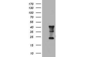 Image no. 8 for anti-Transmembrane Protein 173 (TMEM173) antibody (ABIN1501428) (STING/TMEM173 anticorps)