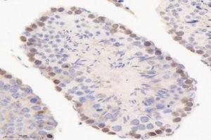 Immunohistochemistry analysis of paraffin-embedded mouse testis using,PME-1 (ABIN7075286) at dilution of 1: 2000 (PPME1 anticorps)