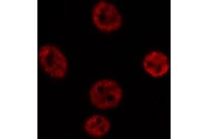 ABIN6269269 staining Hep G2 cells by IF/ICC. (SOX9 anticorps)