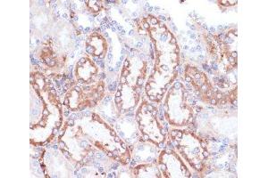 Immunohistochemistry of paraffin-embedded Mouse kidney using GATM Polyclonal Antibody at dilution of 1:100 (40x lens).