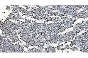 IHC analysis of GRX2/GLRX2 using anti-GRX2/GLRX2 antibody (ABIN7599022). (Glutaredoxin 2 anticorps  (AA 1-164))
