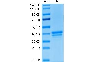 Human BCMA/TNFRSF17 on Tris-Bis PAGE under reduced condition.