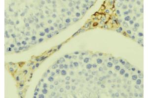 ABIN6273392 at 1/100 staining Mouse testis tissue by IHC-P. (CCL20 anticorps  (Internal Region))