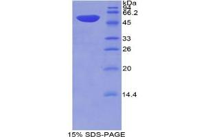 SDS-PAGE analysis of Mouse Thrombospondin 2 Protein. (Thrombospondin 2 Protein (THBS2))