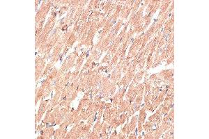 Immunohistochemistry of paraffin-embedded rat heart using KTN1 antibody. (KTN1 anticorps  (AA 1-100))