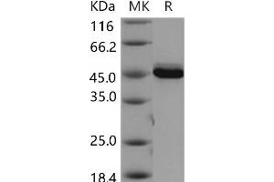 Western Blotting (WB) image for V-Akt Murine Thymoma Viral Oncogene Homolog 3 (Protein Kinase B, Gamma) (AKT3) (Active) protein (ABIN7319999)