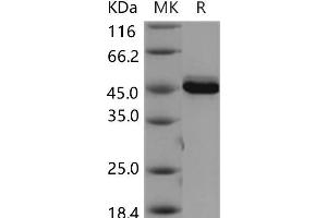 Western Blotting (WB) image for V-Akt Murine Thymoma Viral Oncogene Homolog 3 (Protein Kinase B, Gamma) (AKT3) (Active) protein (ABIN7319999) (AKT3 Protéine)