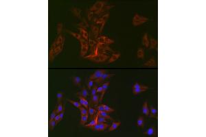 Immunofluorescence analysis of BALB-3T3 cells using DOK1 Rabbit mAb (ABIN7266831) at dilution of 1:100 (40x lens). (DOK1 anticorps)