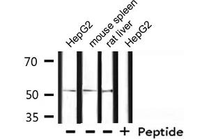 Western blot analysis of extracts from HepG2, mouse spleen, rat liver , using OCT2 Antibody. (Oct-2 anticorps)