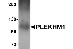 Western Blotting (WB) image for anti-Pleckstrin Homology Domain Containing, Family M (With RUN Domain) Member 1 (PLEKHM1) (N-Term) antibody (ABIN1031519) (PLEKHM1 anticorps  (N-Term))
