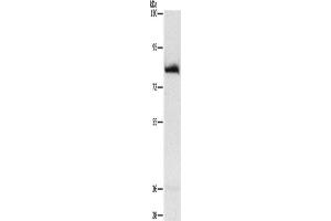 Western Blotting (WB) image for anti-Adenosine Monophosphate Deaminase 1 (AMPD1) antibody (ABIN2432475) (AMPD1 anticorps)