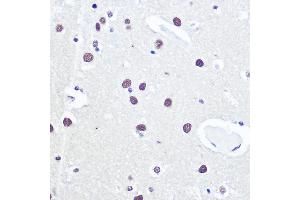 Immunohistochemistry of paraffin-embedded human brain using 53BP1 Rabbit pAb (ABIN6128833, ABIN6149414, ABIN6149415 and ABIN6221431) at dilution of 1:100 (40x lens).