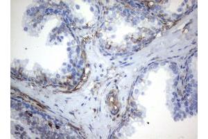 Image no. 6 for anti-Vimentin (VIM) (AA 210-466) antibody (ABIN1491200)