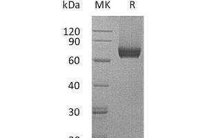 Western Blotting (WB) image for Interleukin 7 Receptor (IL7R) (Active) protein (Fc Tag) (ABIN7320744)