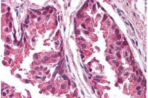 Human Prostate (formalin-fixed, paraffin-embedded) stained with TICAM1 antibody ABIN213993 at 5 ug/ml followed by biotinylated goat anti-rabbit IgG secondary antibody ABIN481713, alkaline phosphatase-streptavidin and chromogen. (TICAM1 anticorps  (C-Term))