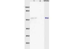 L1 mouse heart lysates L2 mouse pancreas lysates probed with Anti FLIP/c FLIP Polyclonal Antibody, Unconjugated (ABIN725255) at 1:200 overnight at 4 °C.