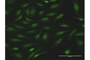 Immunofluorescence of purified MaxPab antibody to NR0B1 on HeLa cell. (NR0B1 anticorps  (AA 1-470))