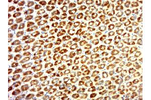 Paraformaldehyde-fixed, paraffin embedded Rat stomach Antigen retrieval by boiling in sodium citrate buffer (pH6.