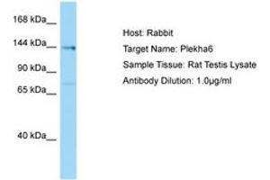 Image no. 1 for anti-Pleckstrin Homology Domain Containing, Family A Member 6 (PLEKHA6) (AA 176-225) antibody (ABIN6749876) (PLEKHA6 anticorps  (AA 176-225))