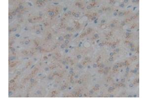 anti-Selectin L (SELL) (AA 109-346) antibody