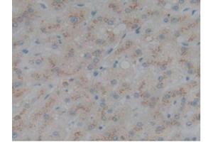 Detection of SELL in Human Liver Tissue using Polyclonal Antibody to Selectin, Leukocyte (SELL) (L-Selectin anticorps  (AA 109-346))
