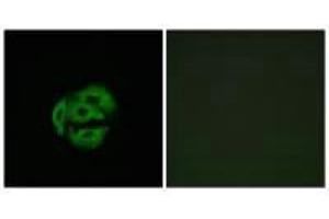 Immunofluorescence analysis of A549 cells, using Cytochrome P450 39A1 antibody. (CYP39A1 anticorps)