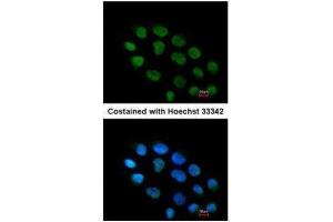 ICC/IF Image Immunofluorescence analysis of paraformaldehyde-fixed A431, using ZNF7, antibody at 1:200 dilution. (ZNF7 anticorps)