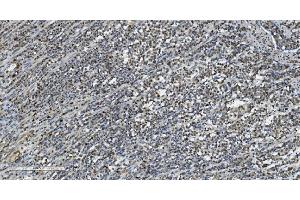 IHC analysis of Transketolase/TKT using anti-Transketolase/TKT antibody (ABIN7598958). (TKT anticorps  (AA 1-116))