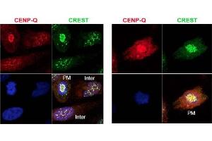 Image no. 1 for anti-Centromere Protein Q (CENPQ) antibody (ABIN401060) (CENPQ anticorps)