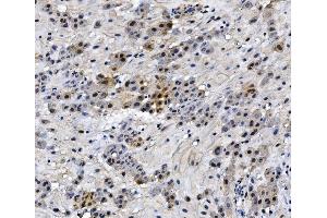 IHC analysis of HMGB3 using anti-HMGB3 antibody (ABIN7603126). (HMGB3 anticorps  (N-Term))