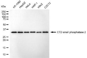 Western blotting analysis using CTD small phosphatase 2 antibody (ABIN7798173).