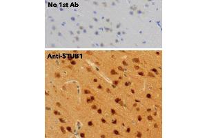 Immunohistochemistry (IHC) image for anti-STIP1 Homology and U-Box Containing Protein 1 (STUB1) antibody (ABIN6254206) (STUB1 anticorps)