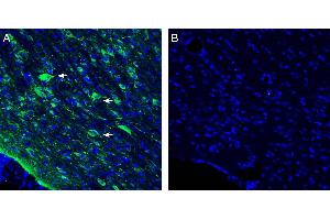 Expression of Vasopressin V1A Receptor in rat horizontal diagonal band. (AVPR1A anticorps  (Intracellular))