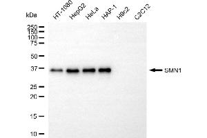Western blotting analysis using SMN1 antibody (ABIN7800470). (Recombinant SMN1 anticorps)