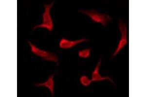 ABIN6275511 staining HeLa by IF/ICC.