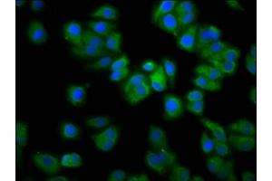 Immunofluorescence staining of HepG2 cells with ABIN7167248 at 1:133, counter-stained with DAPI. (RAB21 anticorps  (AA 141-222))
